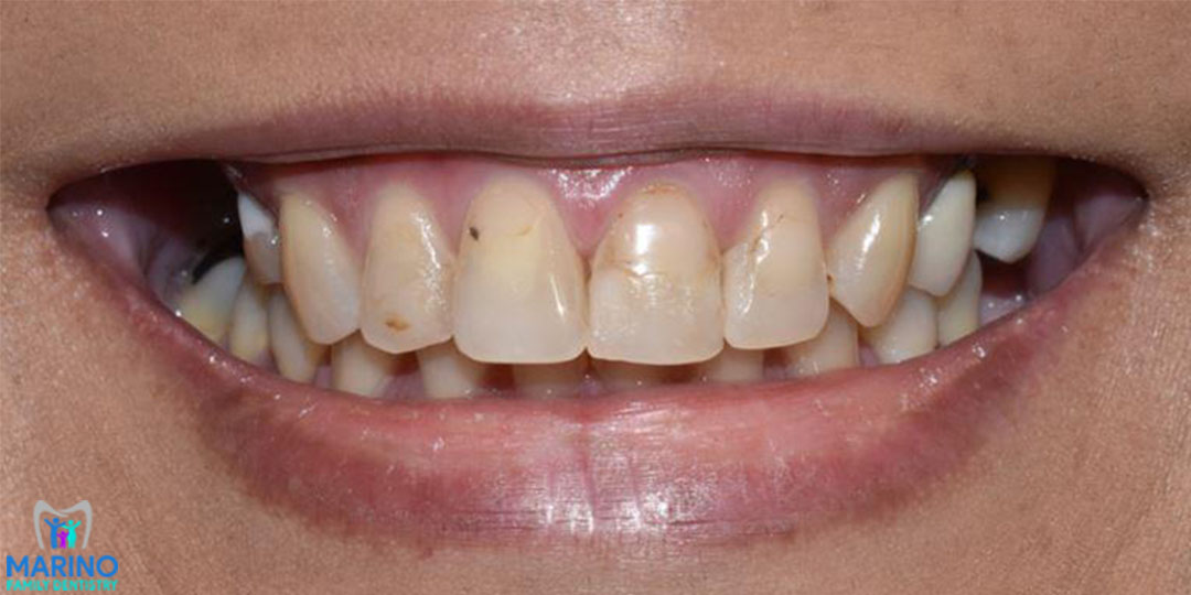 Teeth Whitening Dentist Greater Jacksonville Florida