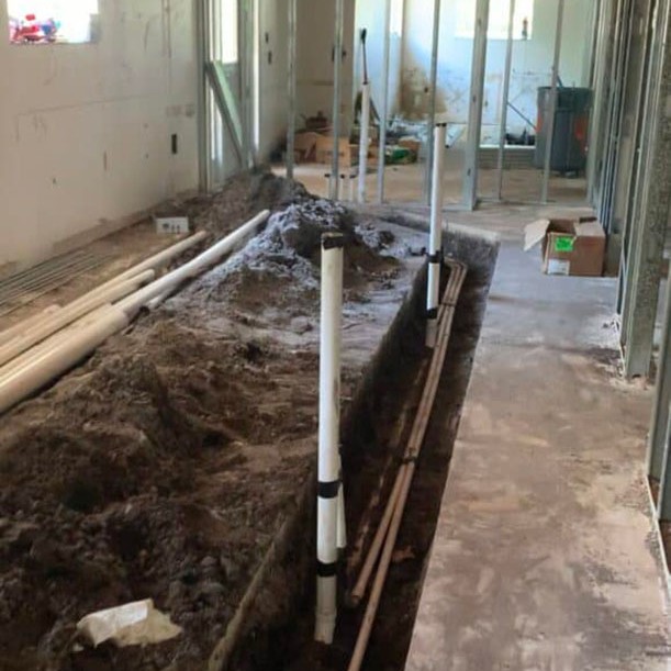 06 Cerec Crown Dentist Near Me