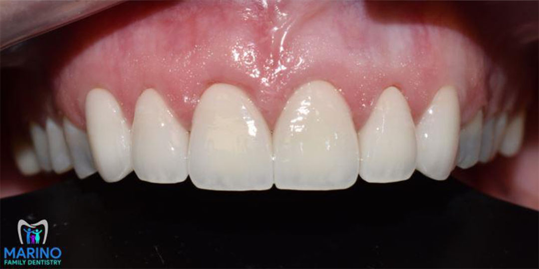 Cosmetic Dentists Near Me