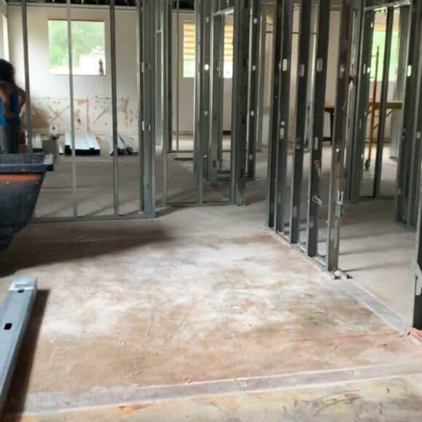 07 Porcelain Veneer Dentist Greater Jacksonville Florida