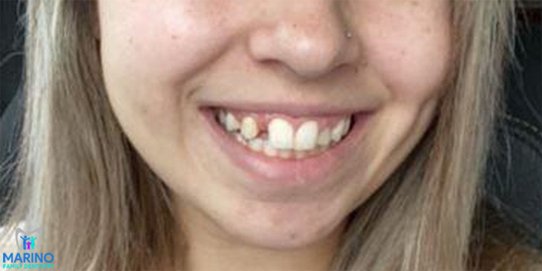 Family Dentist In Greater Jacksonville Florida