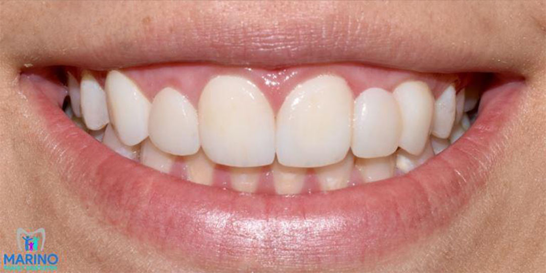 Greater Jacksonville Florida Invisalign Dentist