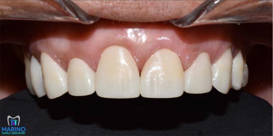 Denture Dentists Greater Jacksonville Florida