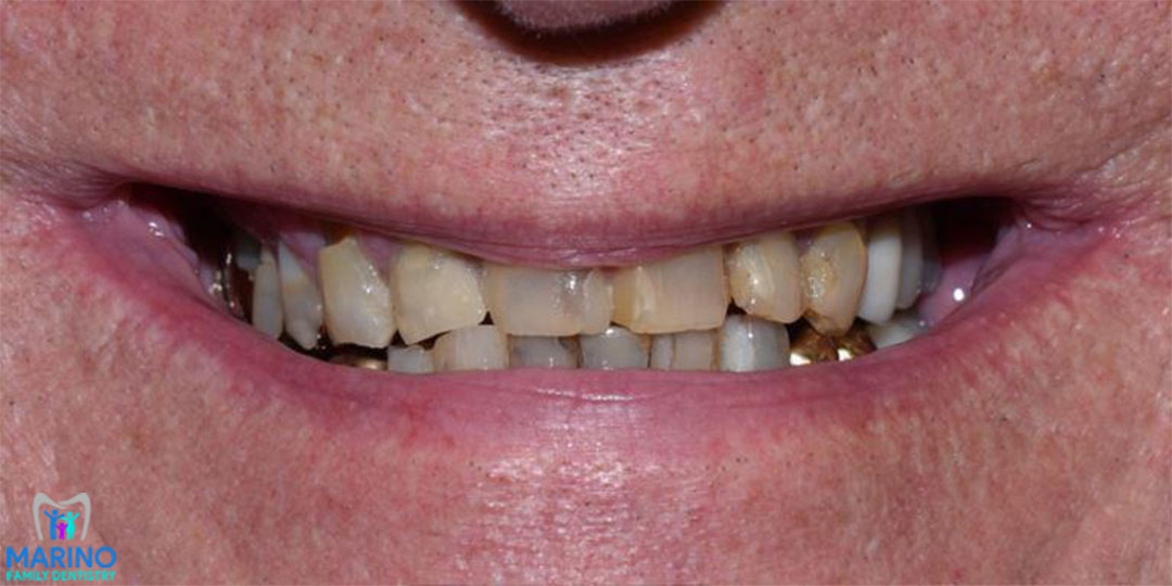 Orange Park Florida Denture Dentist