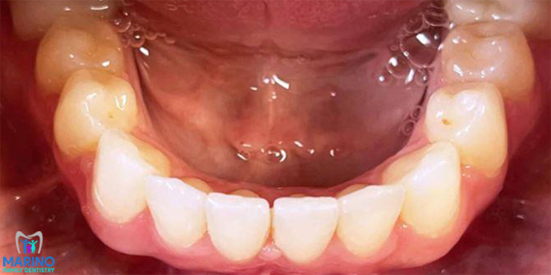 Greater Jacksonville Florida Smile Restorations