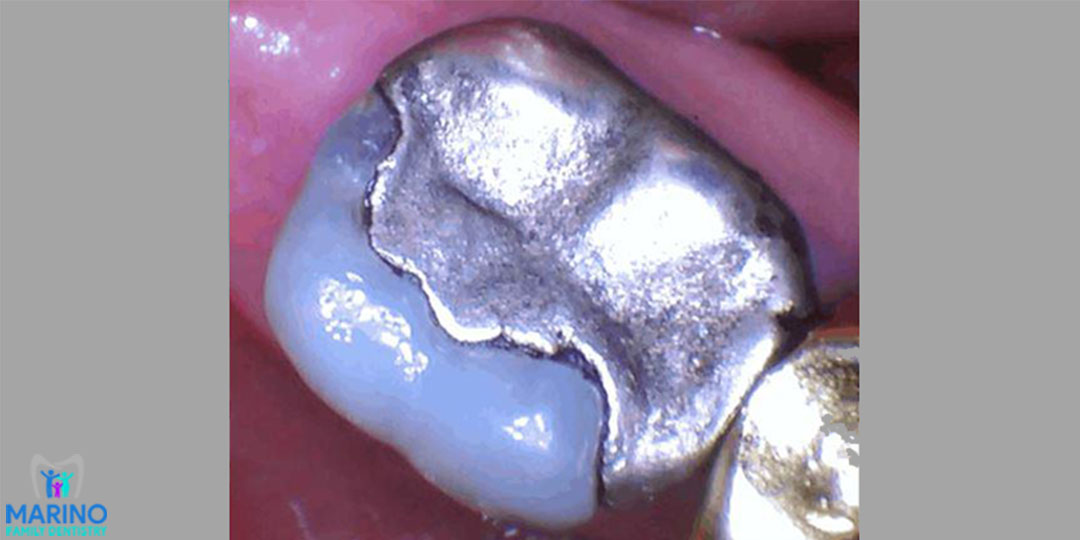 Cosmetic Dentists Near Me