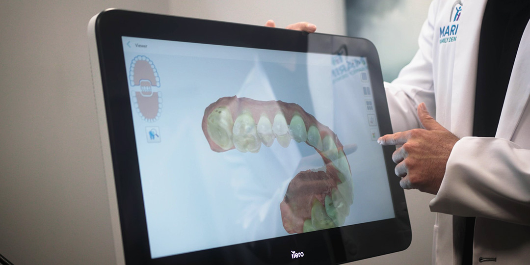 Greater Jacksonville Florida Tooth Extraction Dentist